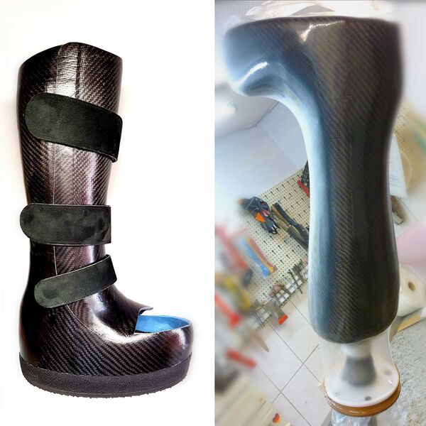 Herstellung einer Totalentlastungsorthese aus Carbon