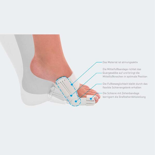 HALLUFIX® HALLUX VALGUS